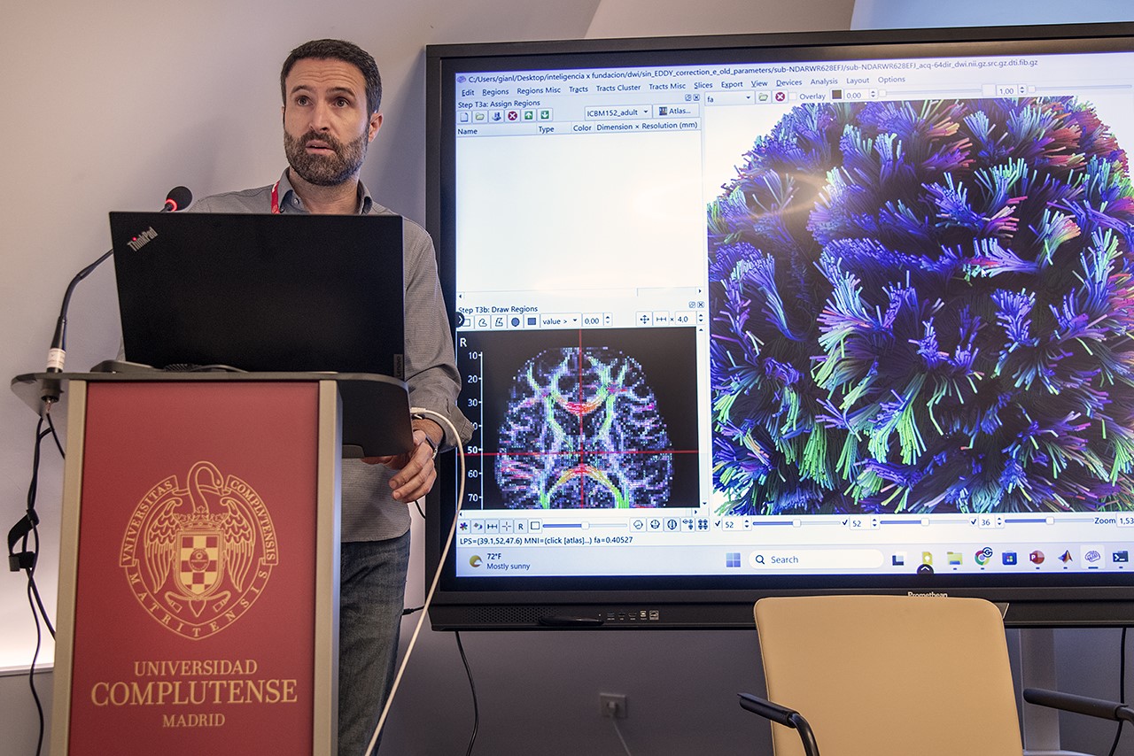 ¿Puede la neuromodulación mejorar las funciones cognitivas? - 3